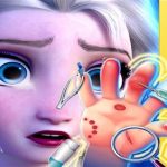 Elsa Hand Doctor – zabavne igre za djevojčice na mreži